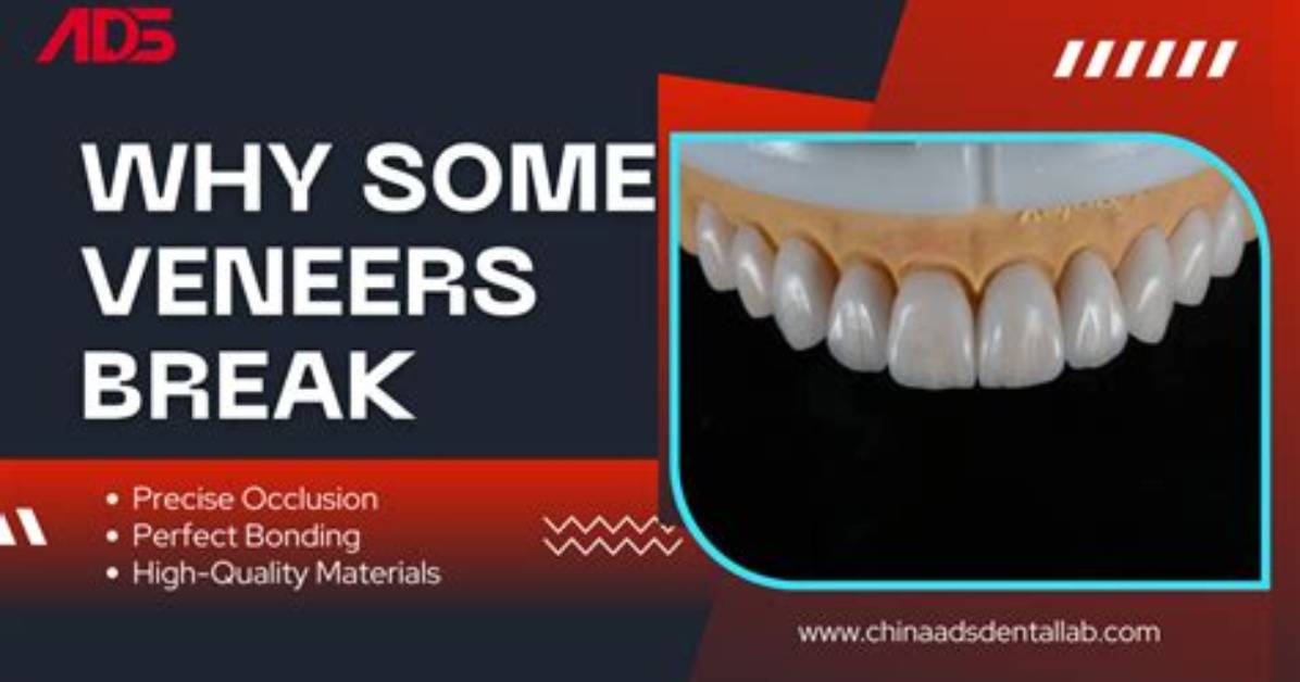 Why Do My Veneers Keep Breaking?