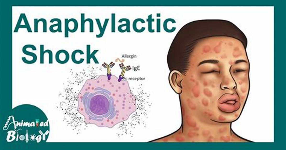 Why Do Peanuts Cause Anaphylactic Shock