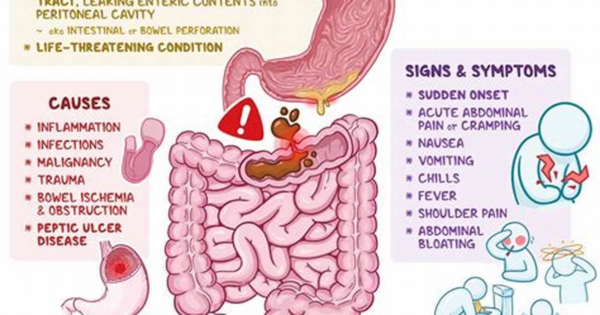 Why Do Steroids Cause Bowel Perforation?