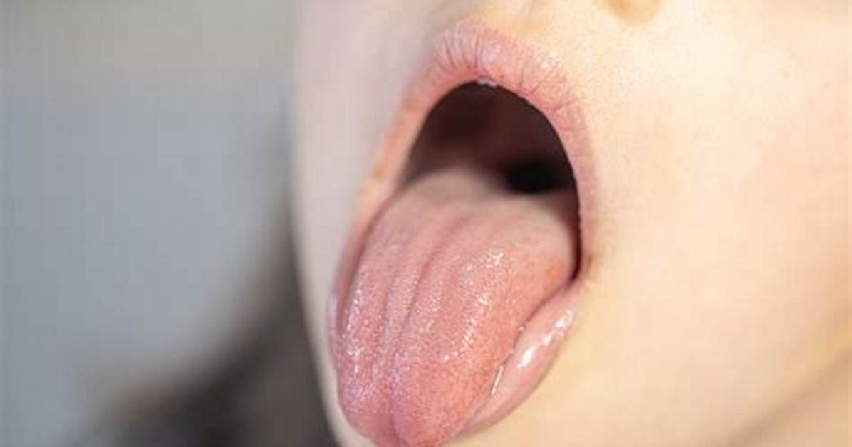Why Do We Bite Our Tongue Accidentally?