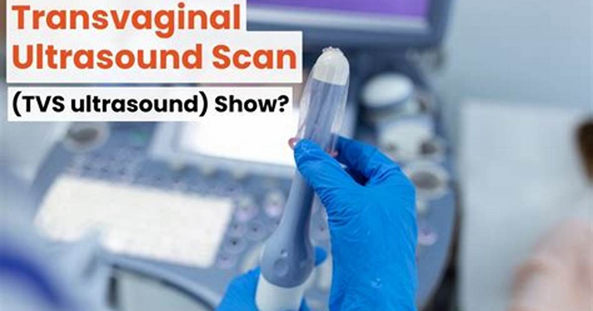 Why Do You Get a Sonogram?