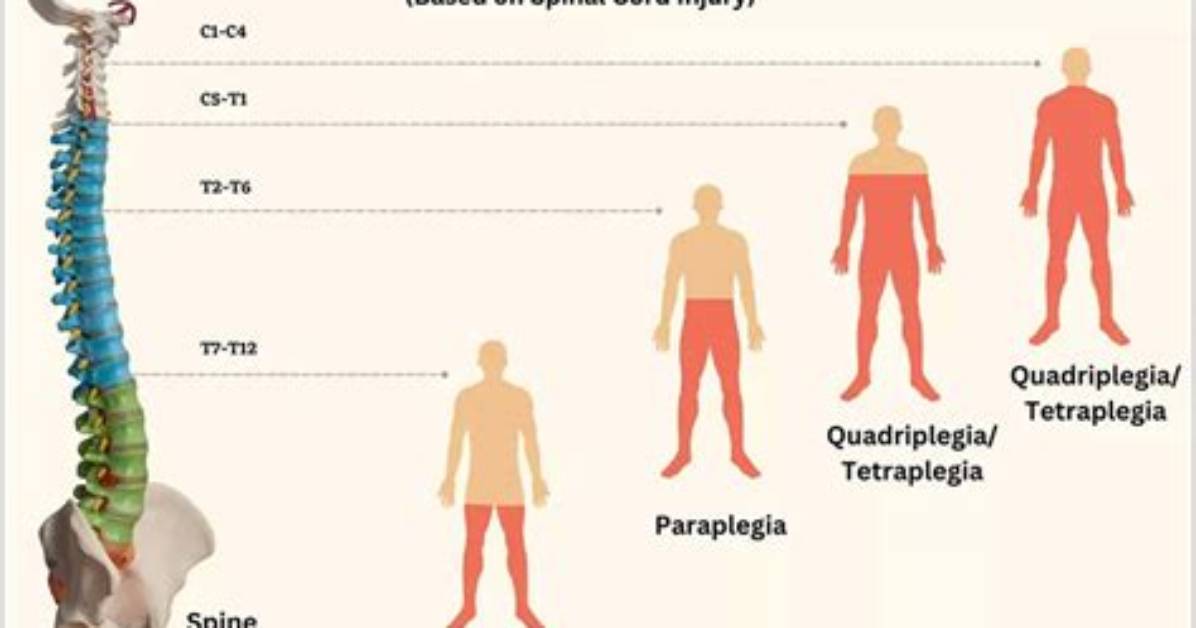 Why Does a Broken Spine Cause Paralysis?