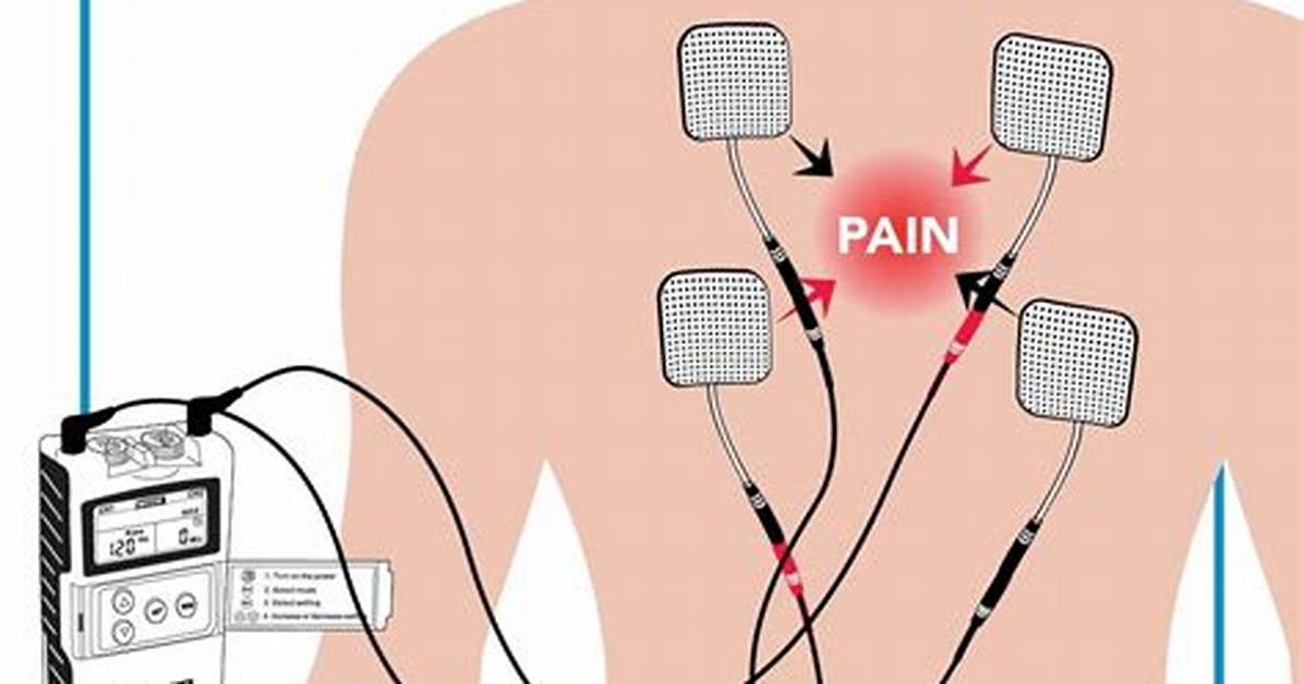 Why Does a Tens Unit Help with Pain