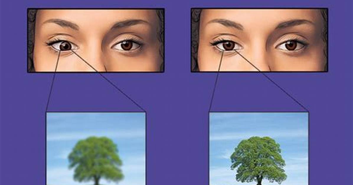 Why Does Amblyopia Occurs?