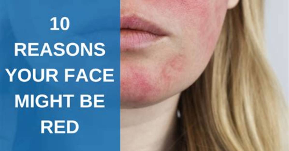 Why Does My Face Turn Red After a Shower?