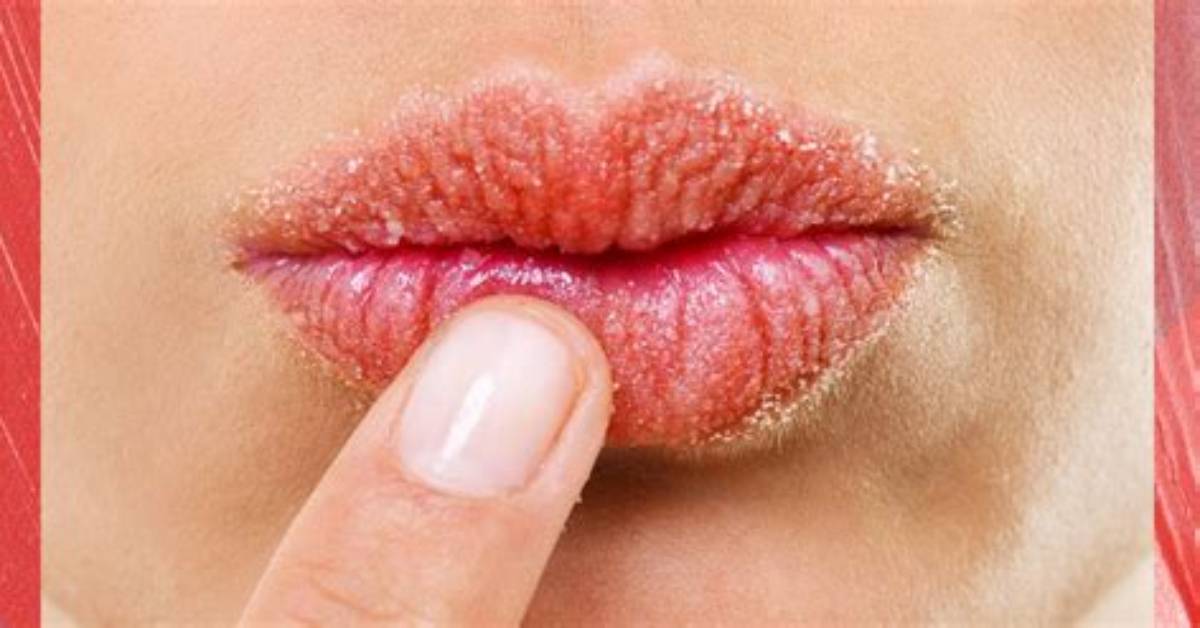 Why Does My Lips Dry?