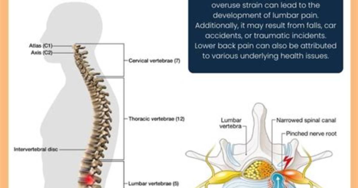 Why Does My Lumbar Hurt?