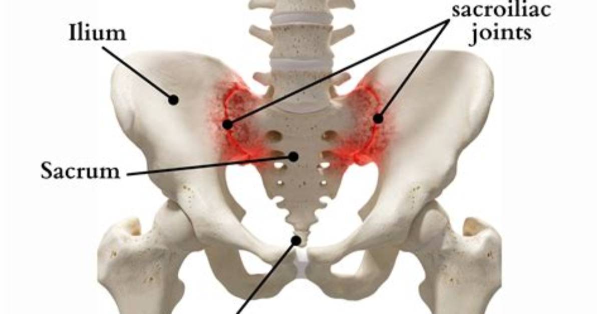 Why Does My Sacrum Hurt?