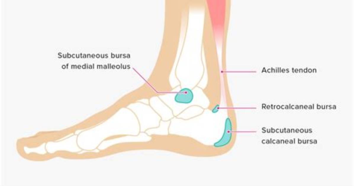 Why Does My Subcutaneous Calcaneal Bursa Hurt