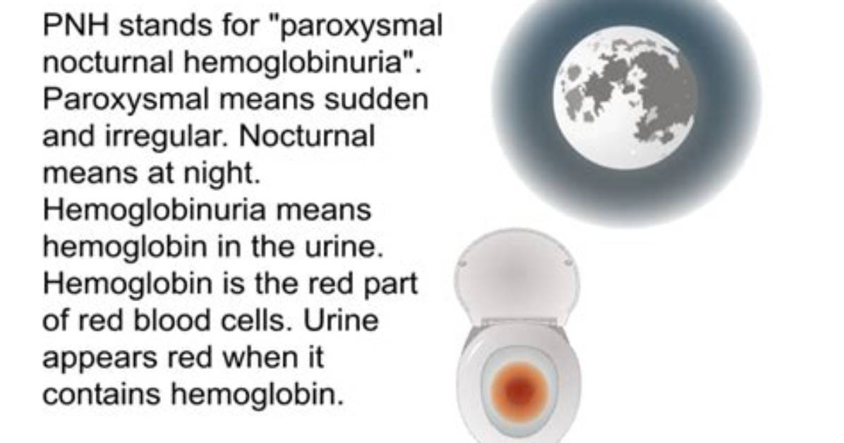 Why Does Pnh Happen at Night?