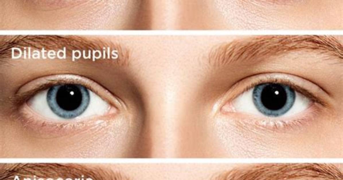 Why Does Scopolamine Cause Pupil Dilation?