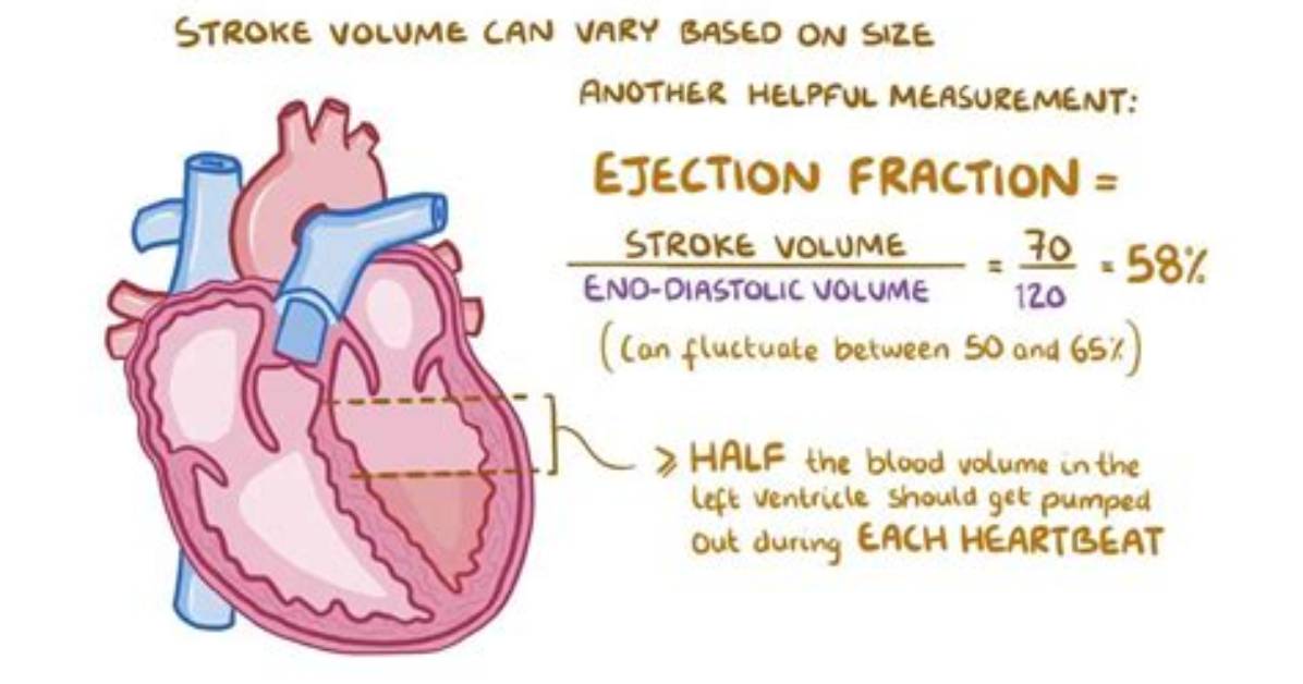 Why Does Stroke Volume Increase with Long Term Exercise