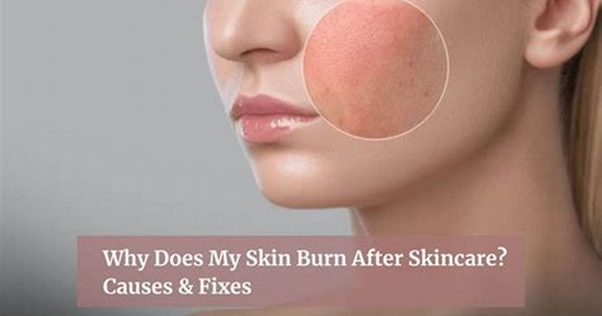 Why Does Tincture Burn?