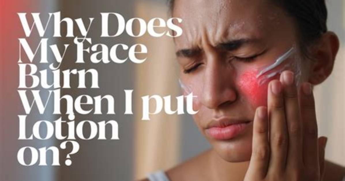Why Does Visine Burn Sometimes?