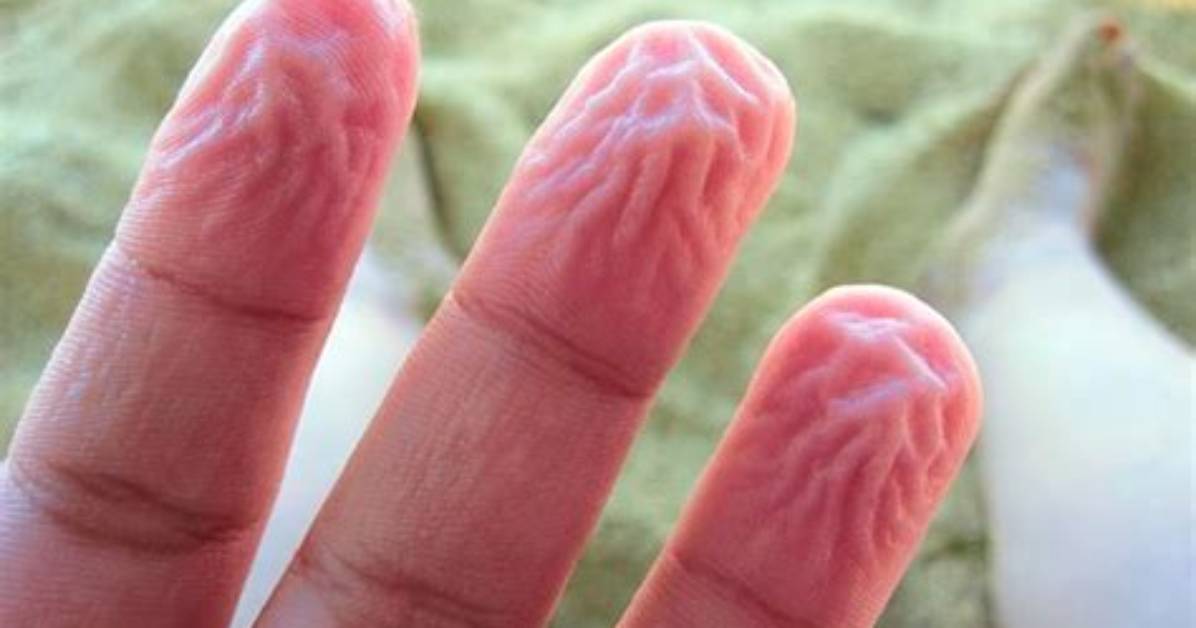 Why Does Your Skin Get Pruney in Water