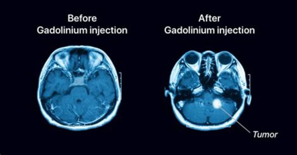 Why Gadolinium Is Used?