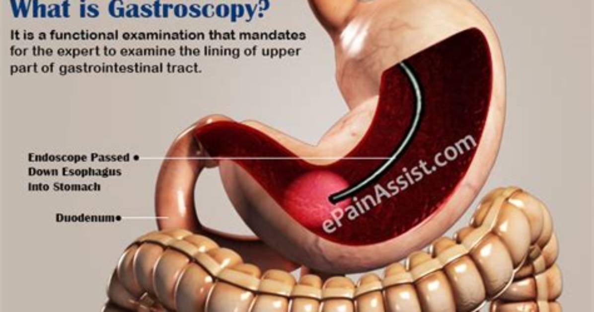 Why Gastroscopy Is Done?