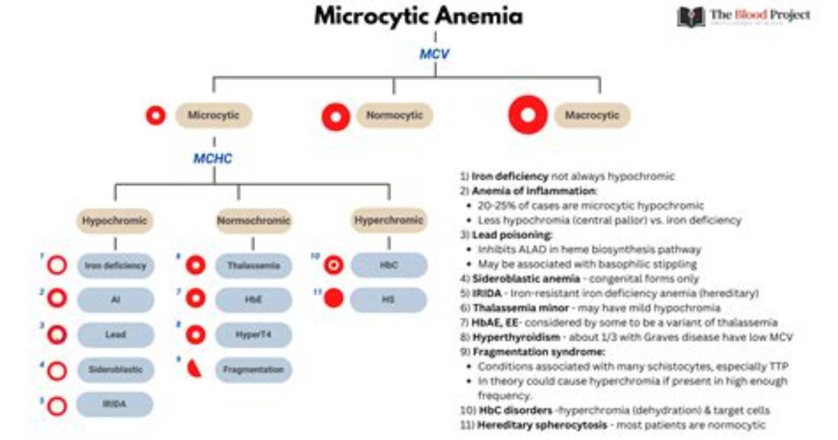 Why Ida Is Microcytic?