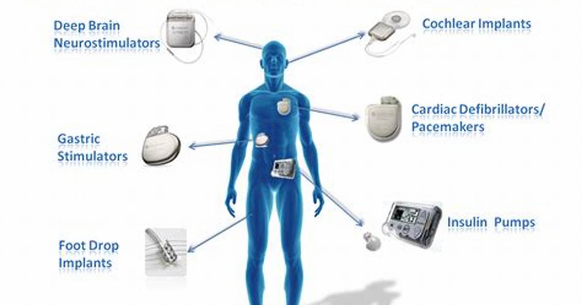 Why Implantable Hearing Devices?