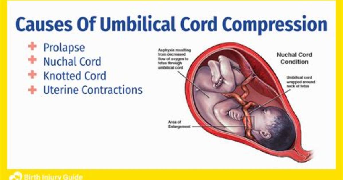 Why Inspecting Umbilical Cord?