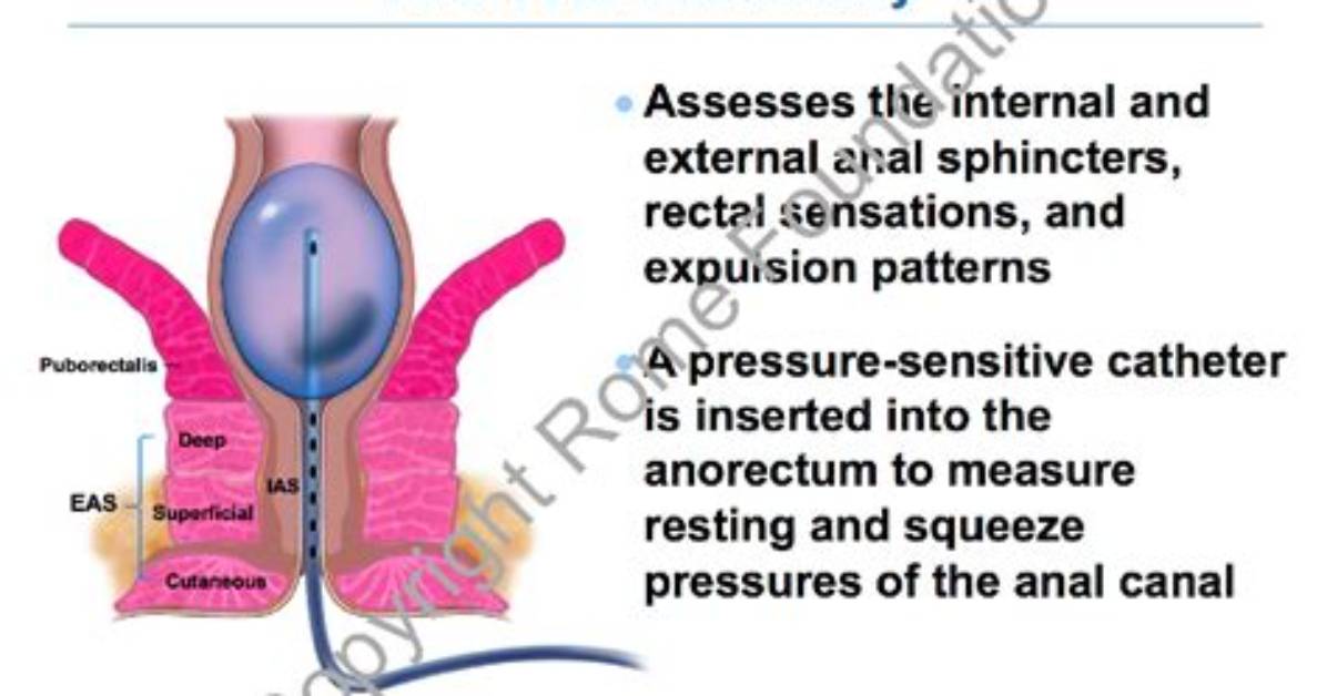 Why Is Anorectal Manometry Done?