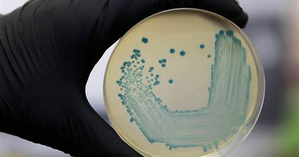 Why Is Bacteriology Important?