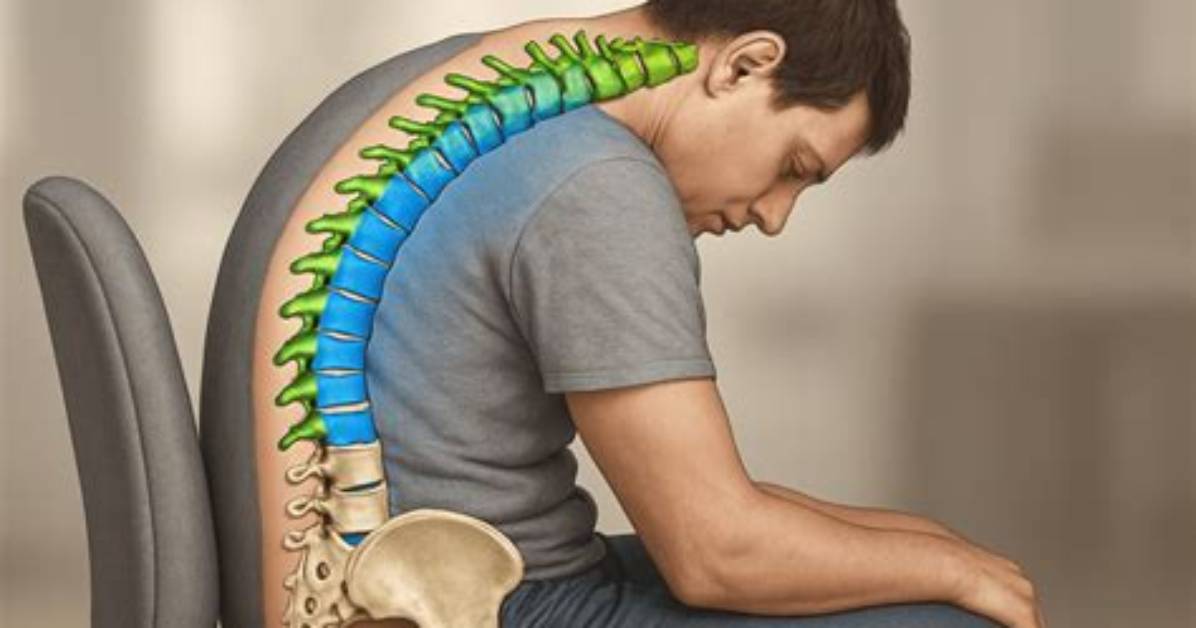 Why Is Bad Posture Bad?