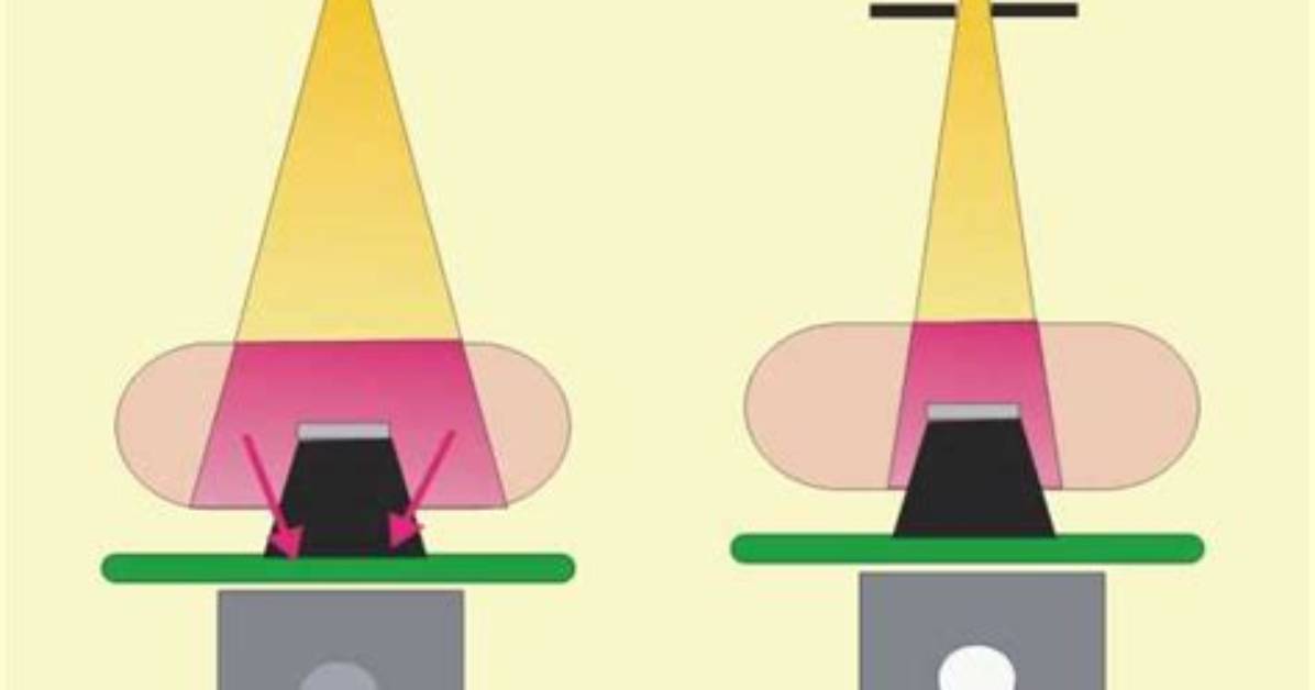 Why Is Collimation Important in Radiology?