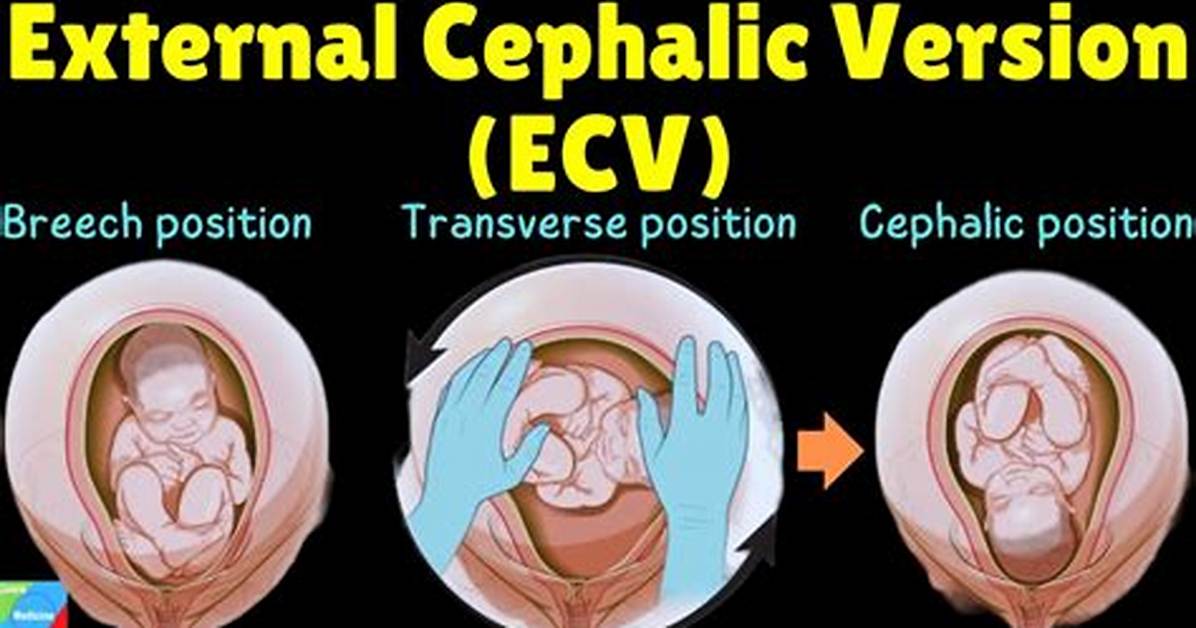 Why Is Ecv Safe?