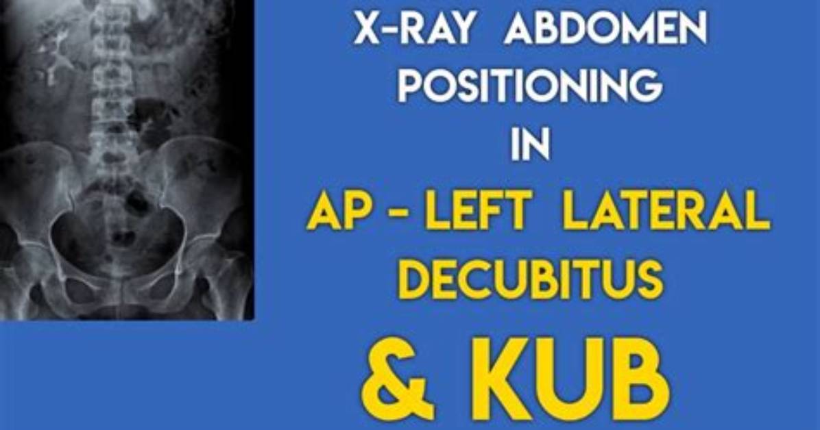 Why Is It Called a Kub