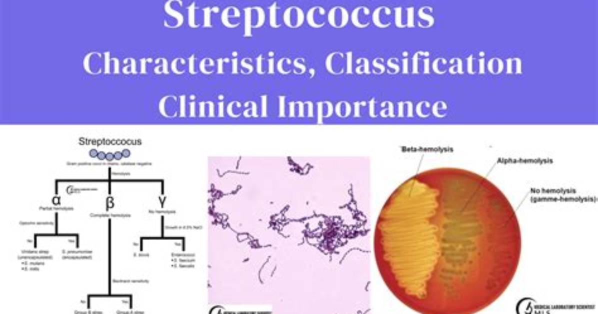 Why Is It Important to Identify Streptococci Quickly?