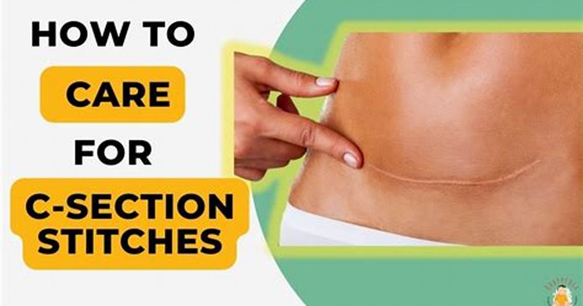 Why Is My C Section Incision Leaking?