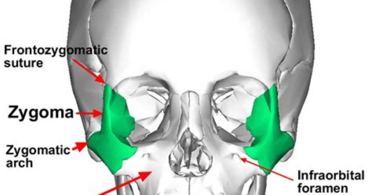 Why Is My Zygomatic Bone Swelling?
