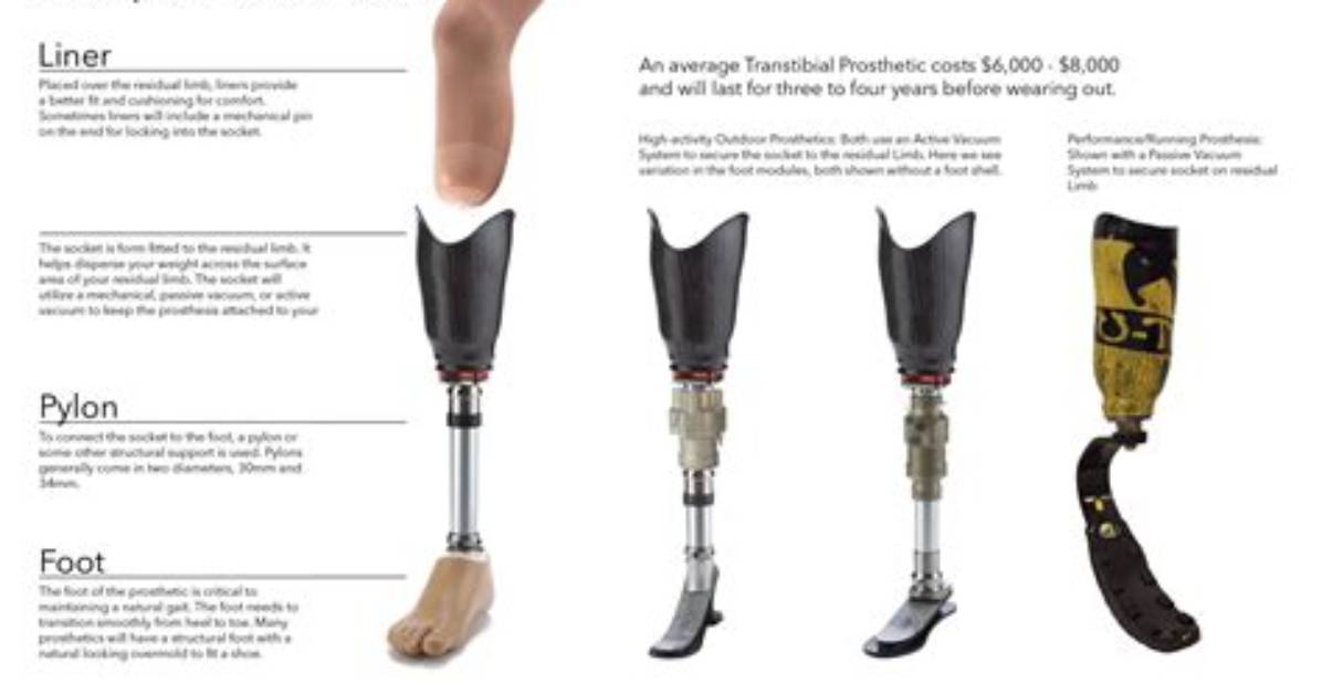 Why Is Prosthesis Important?