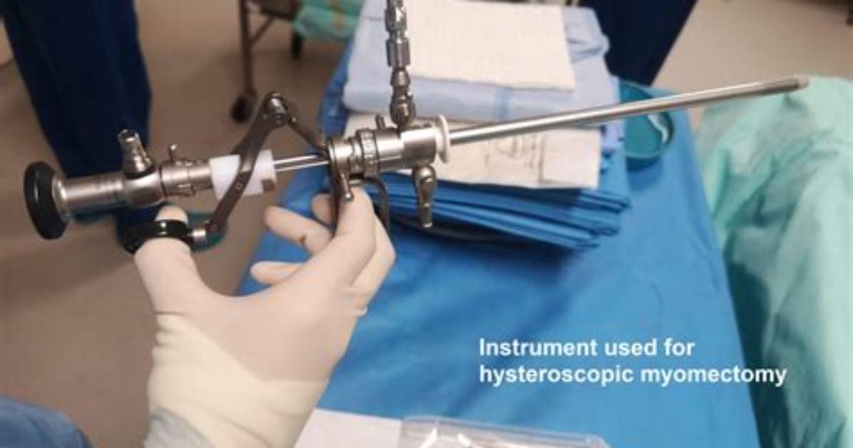 Why Is Resectoscope Used?