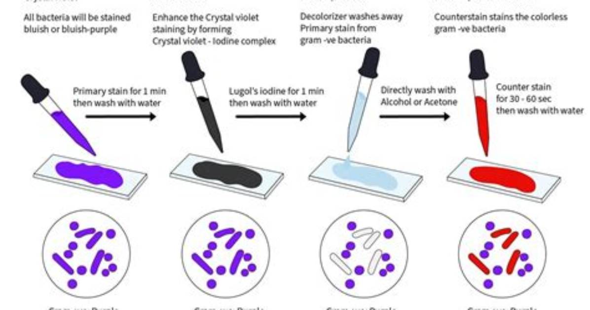 Why Is Staining Important in Bacteriological Examination?