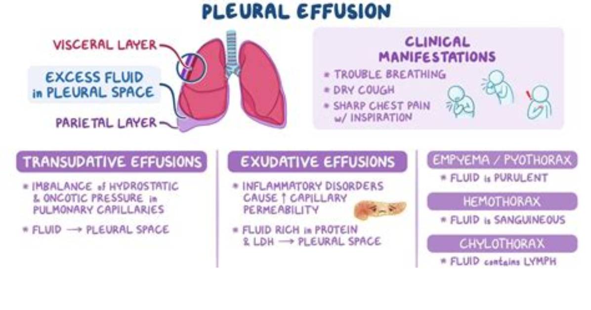 Why Is the Difference Between Effusion and Diffusion?