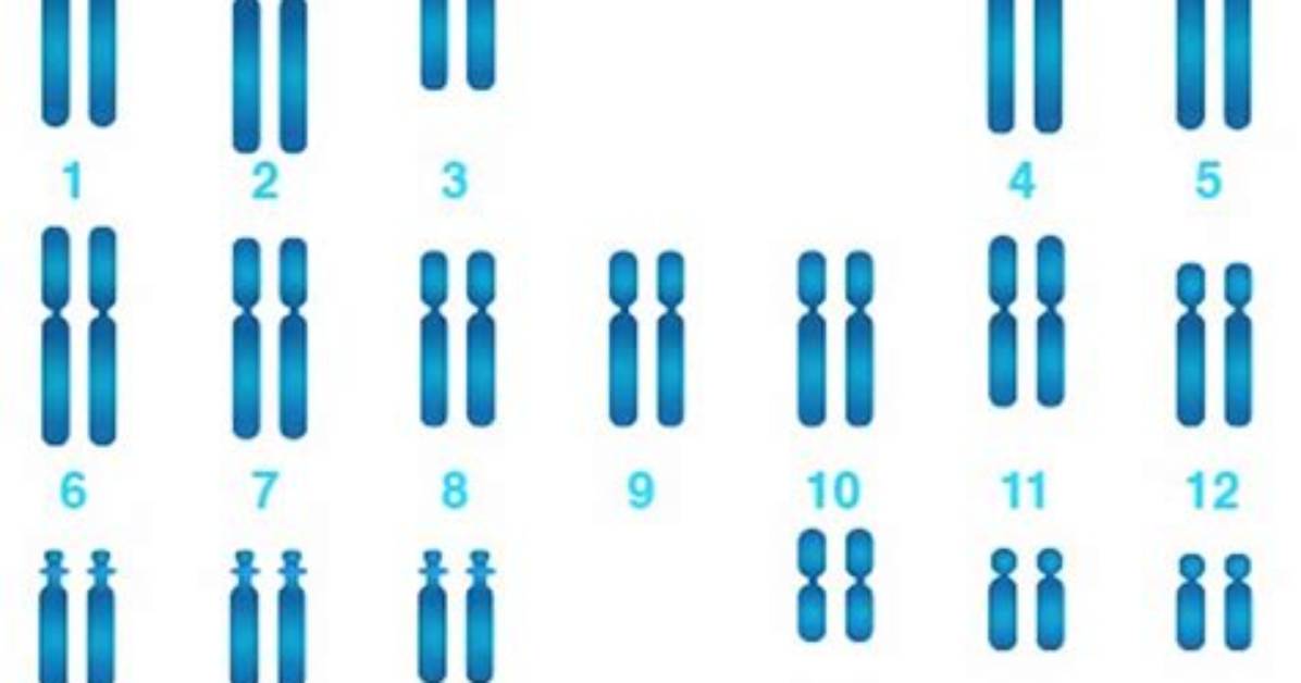 Why Karyotype Test Is Done?