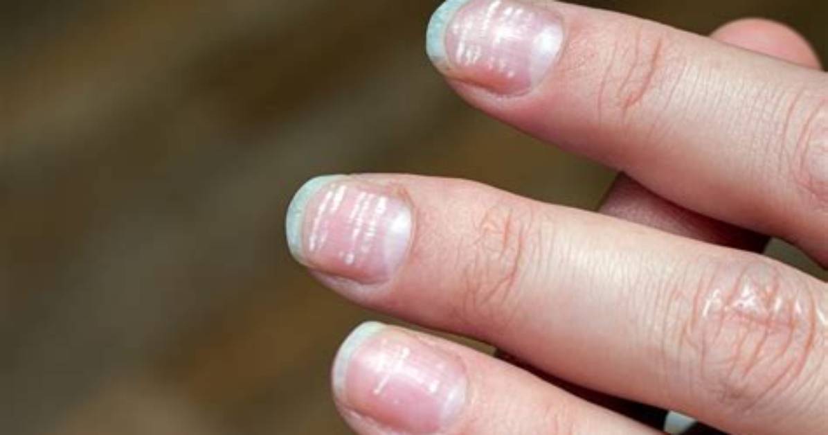 Why Lining on Nails?