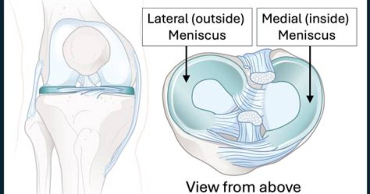 Why Meniscus Is Formed?