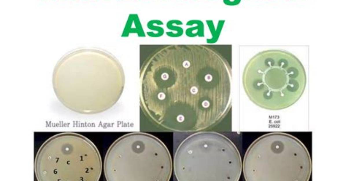 Why Microbiological Assay Is Important?