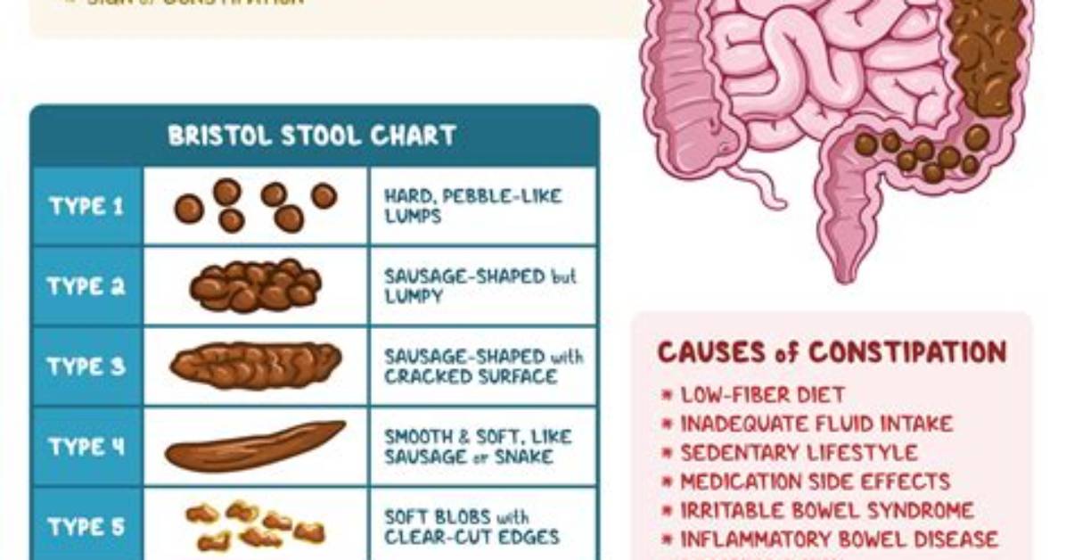 Why My Colon Hurts?