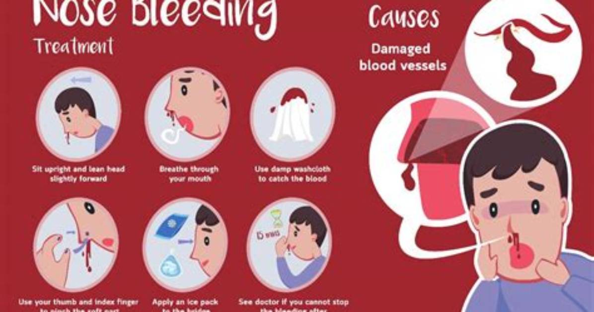 Why Nose Bleeding Happens?