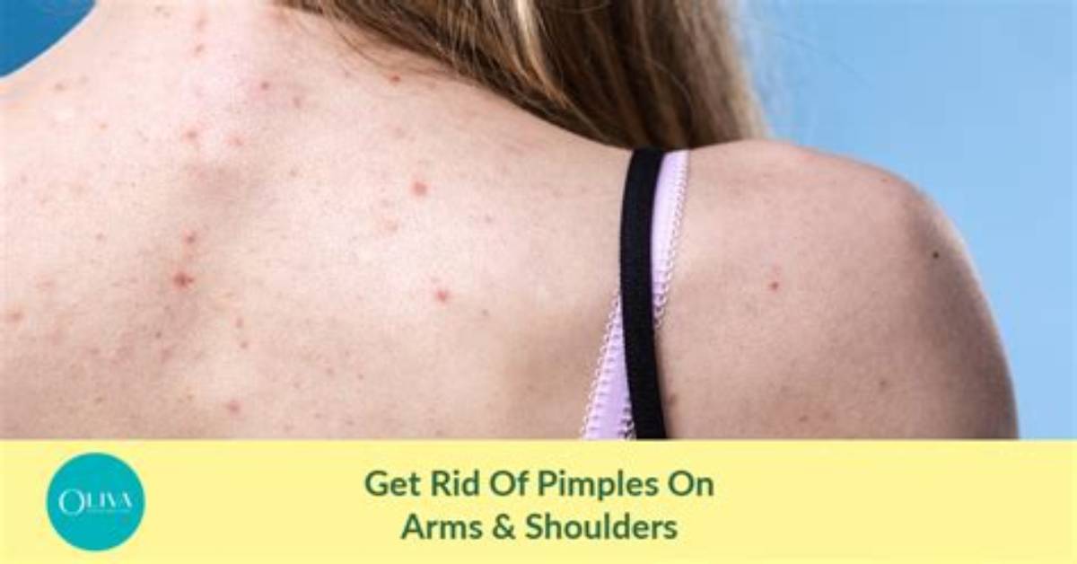 Why Small Pimples on Arms?