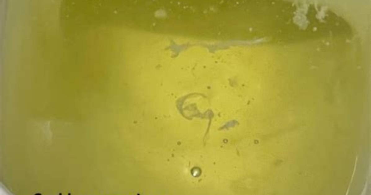 Why Specks in Pee?