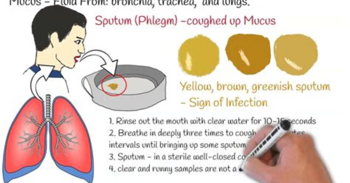 Why Sputum Test Is Done?