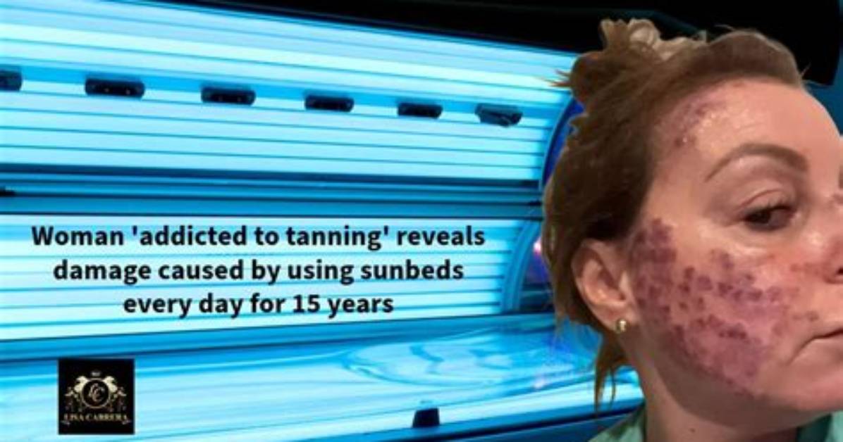Why Tanning Is Bad?