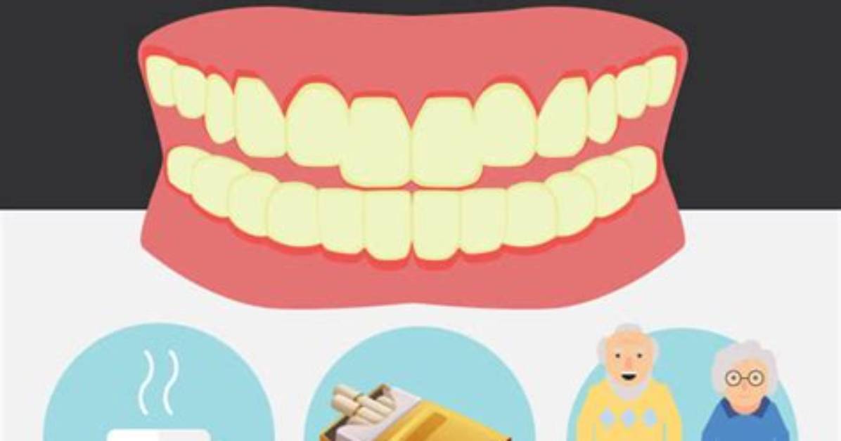 Why Teeth Turn Yellow?
