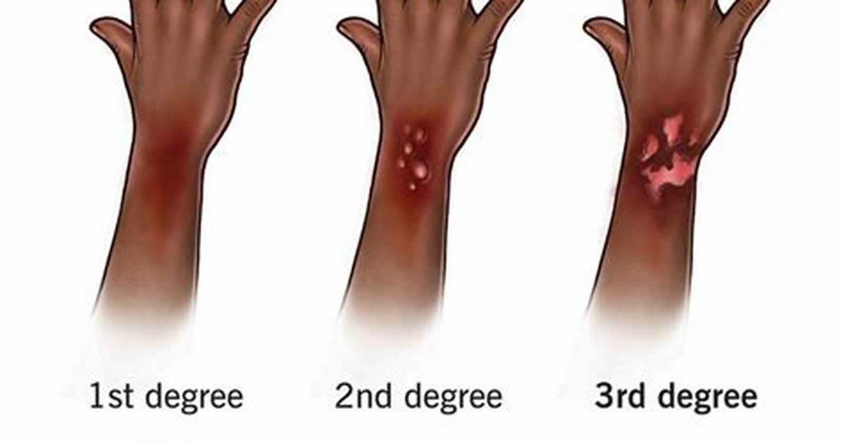 Why the 3Rd Degree?