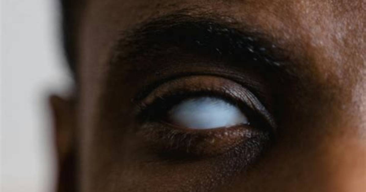Why Turned a Blind Eye?
